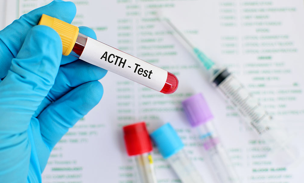 acth-test-desktop