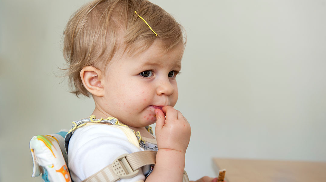 desktop_Toddler-with-hand-foot-and-mouth-disease_GettyImages-182093379