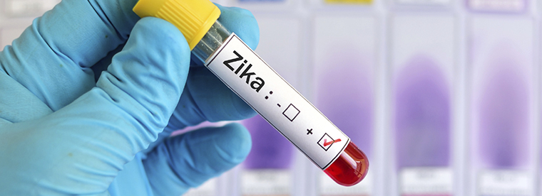 Zika-Test-Tube-3