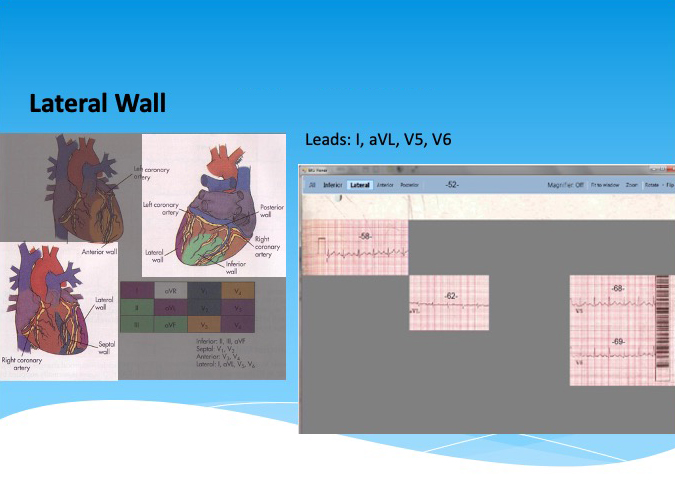 MI Viewer | MedStar Health
