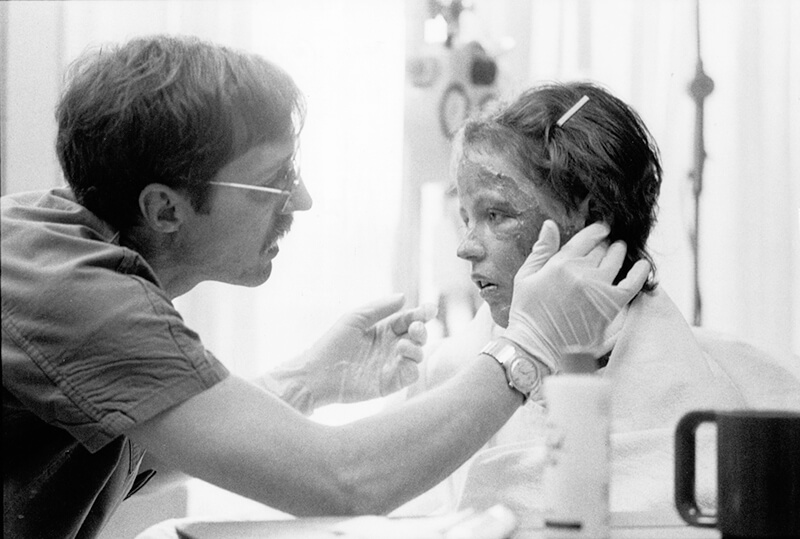 A medical practitioner attending to a female child burn victim