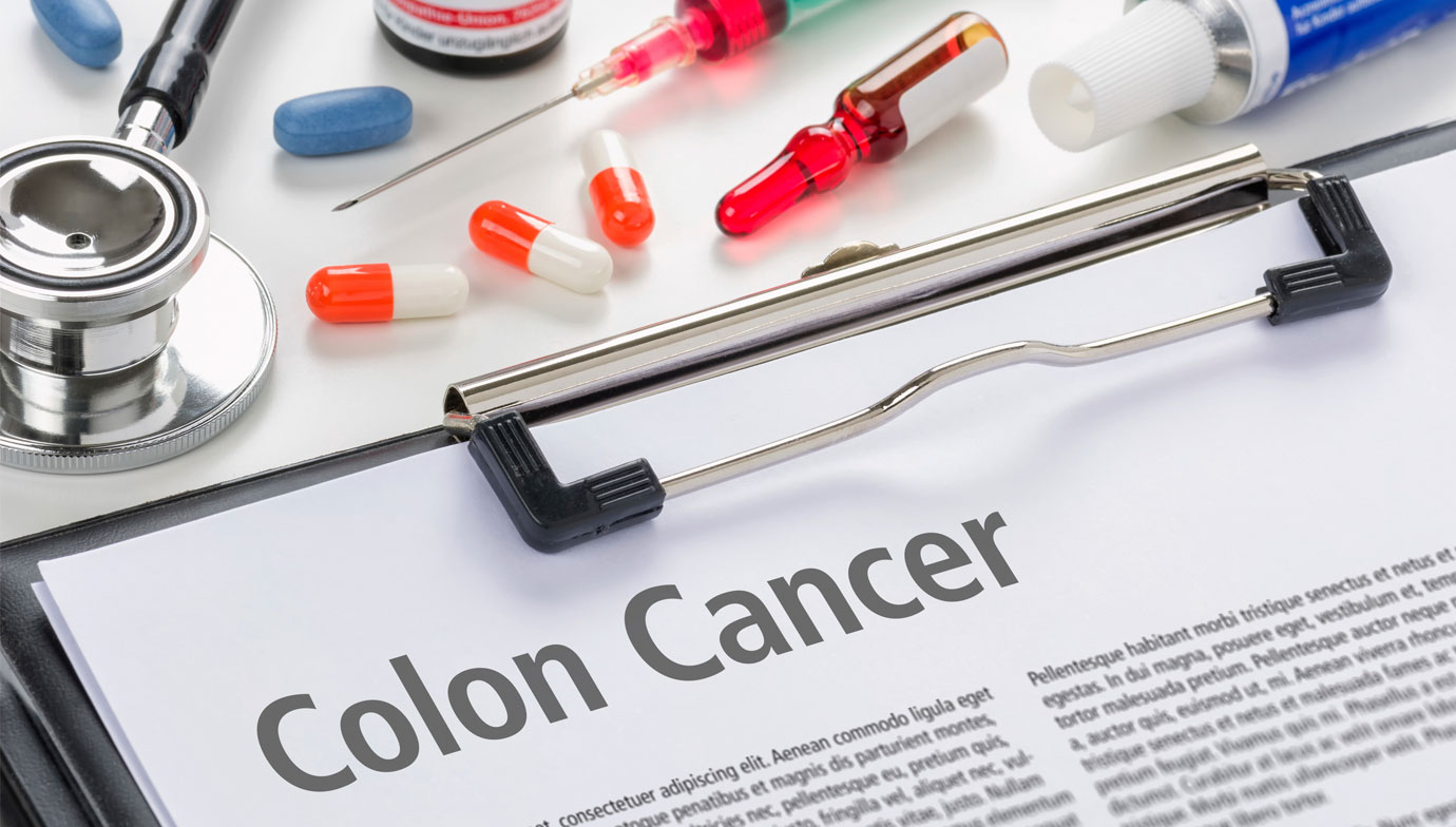 colon-cancer-photo-press-release