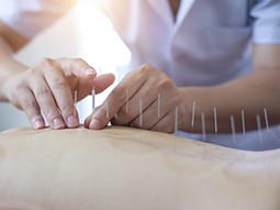 Acupuncture specialist giving acupuncture therapy