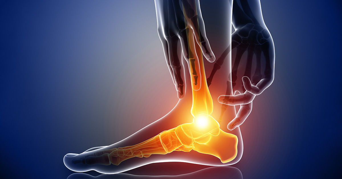 Think You Have a Pinched Nerve? - Baltimore MD Physical Therapy for Sports  and Injury Rehab