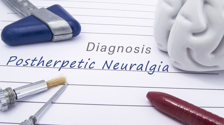 postherpetic neuralgia