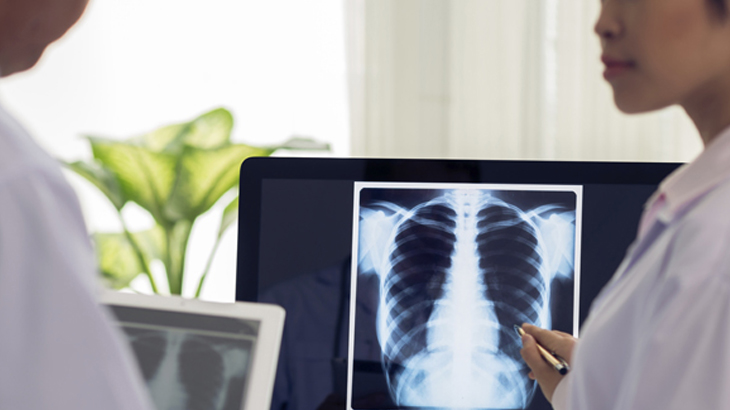 How interventional radiology can change healthcare cognizant at bangalore