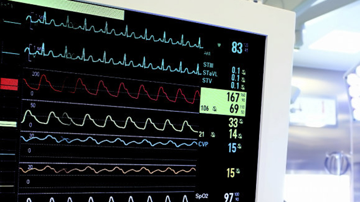 Medical monitor in the operating room.