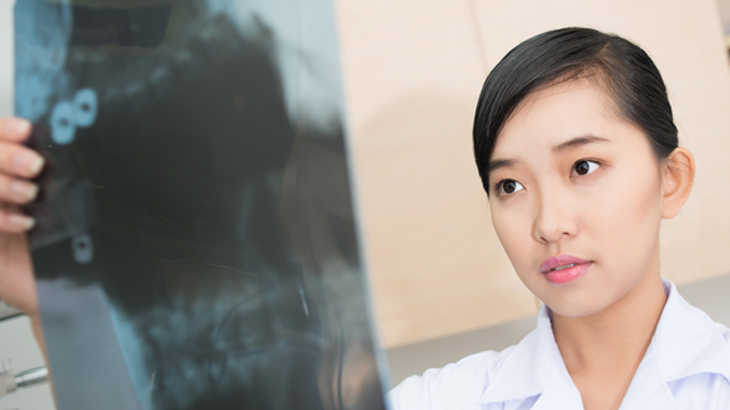 Doctor checking x-ray