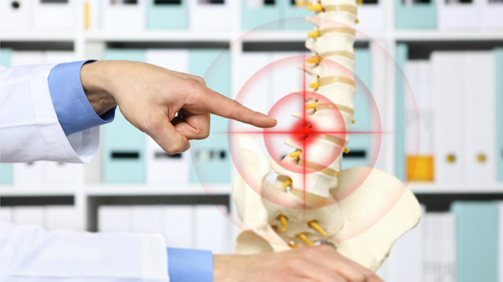 doctor explaining 3d model of spine