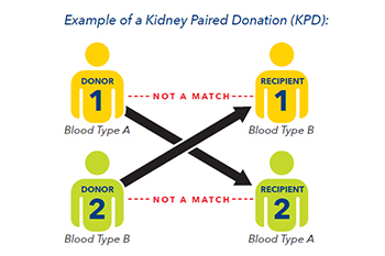 Graphic showing example of a paired kidney exchange