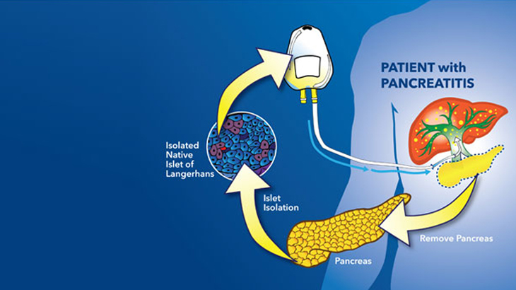 Islet-Cell-Procedure