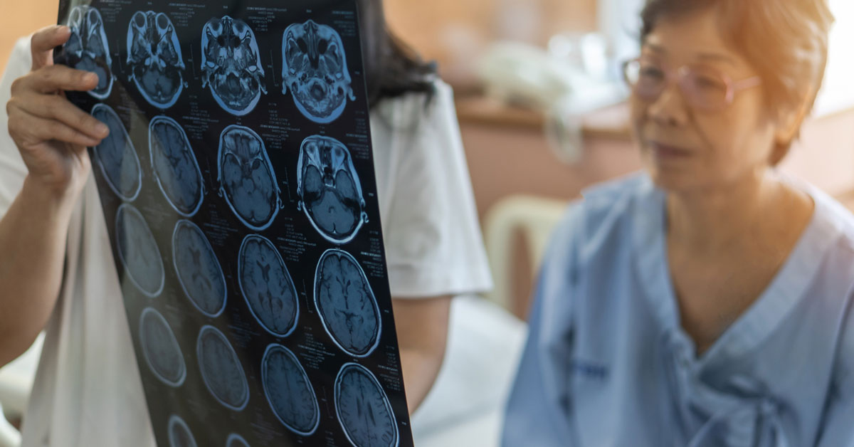 Senior female patient reviewing brain scan in hospital setting